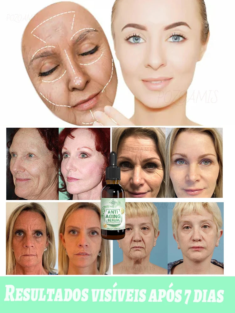 Diga adeus às rugas – a escolha nº1 de quem ama cuidar da beleza! - Serena Store