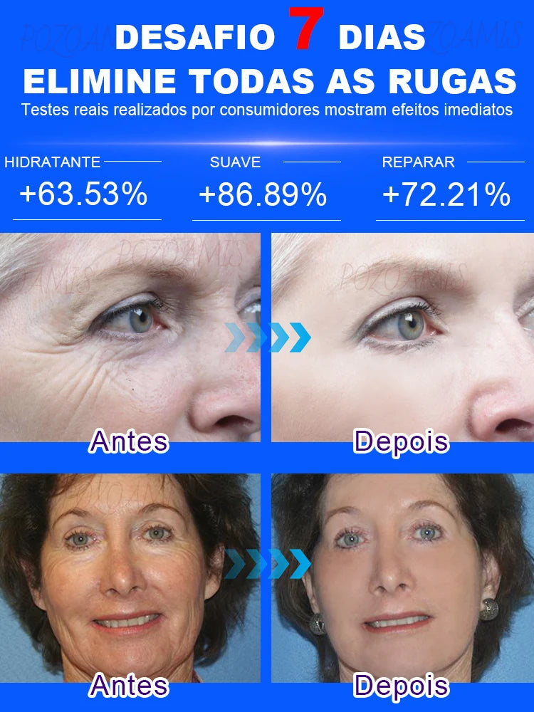 Diga adeus às rugas – a escolha nº1 de quem ama cuidar da beleza! - Serena Store
