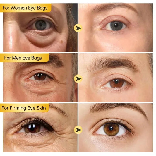 Creme para Área dos Olhos com Retinol – Reduz Bolsas, Olheiras e Linhas Finas Instantaneamente - Serena Store