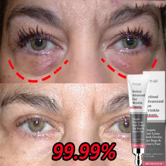 Creme para Área dos Olhos com Retinol – Reduz Bolsas, Olheiras e Linhas Finas Instantaneamente - Serena Store